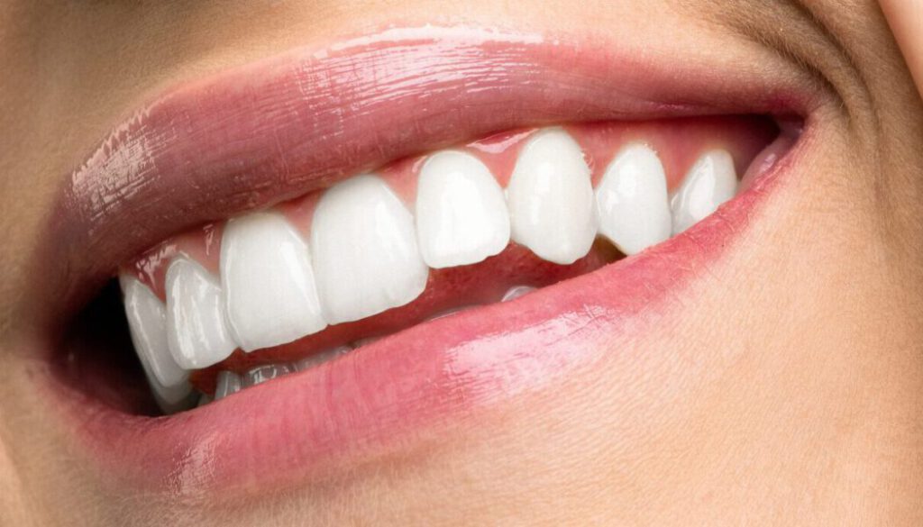 Schöne Zähne einer Frau sind sichtbar, umrahmt von ihren Lippen; sie hält ihren Kopf schräg und der Blick schaut von unten schräg links, Zahnarzt
