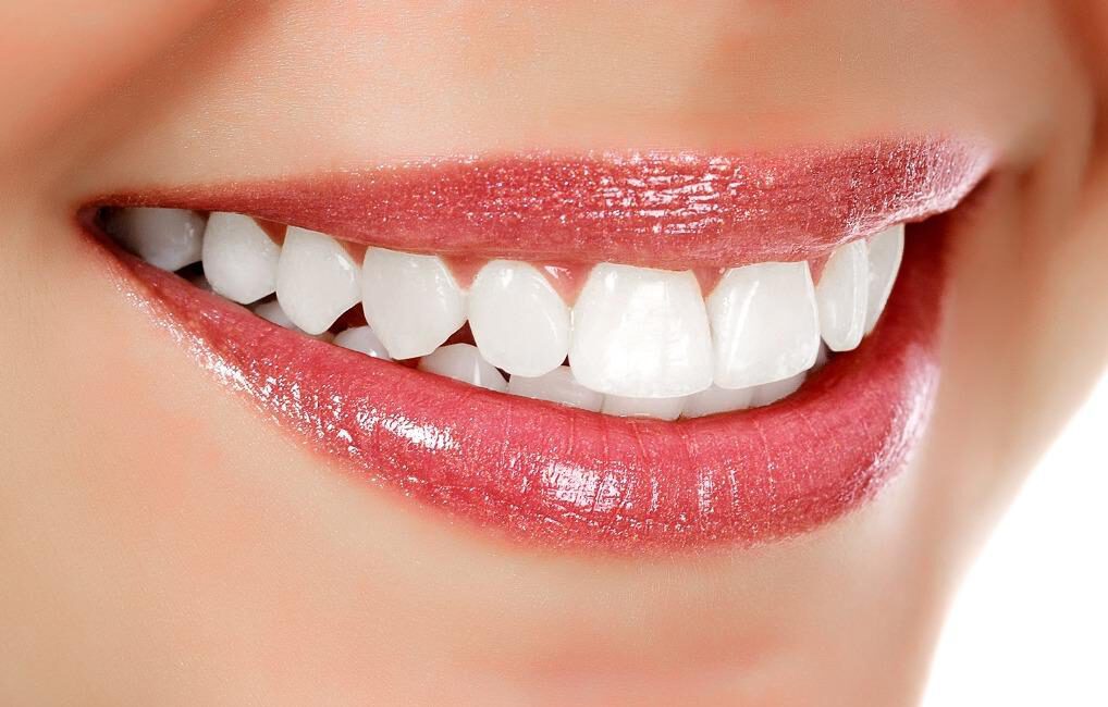 Schöne jugendliche Zähne, weiß und sexy umrahmt von verführerisch roten Lippen, Zahnarzt